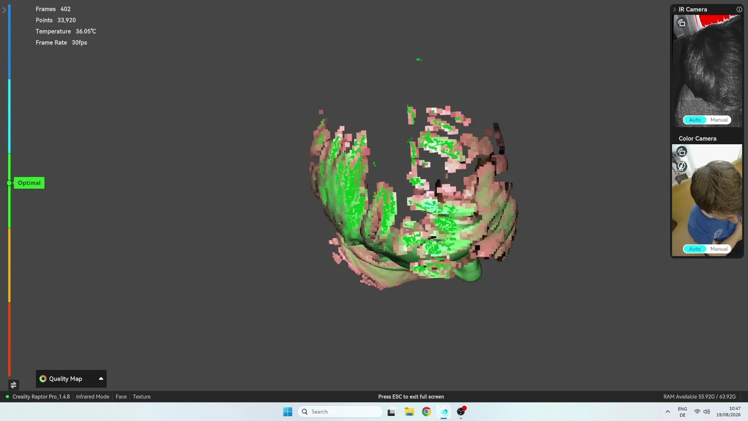 The head scan with patchy hair capture