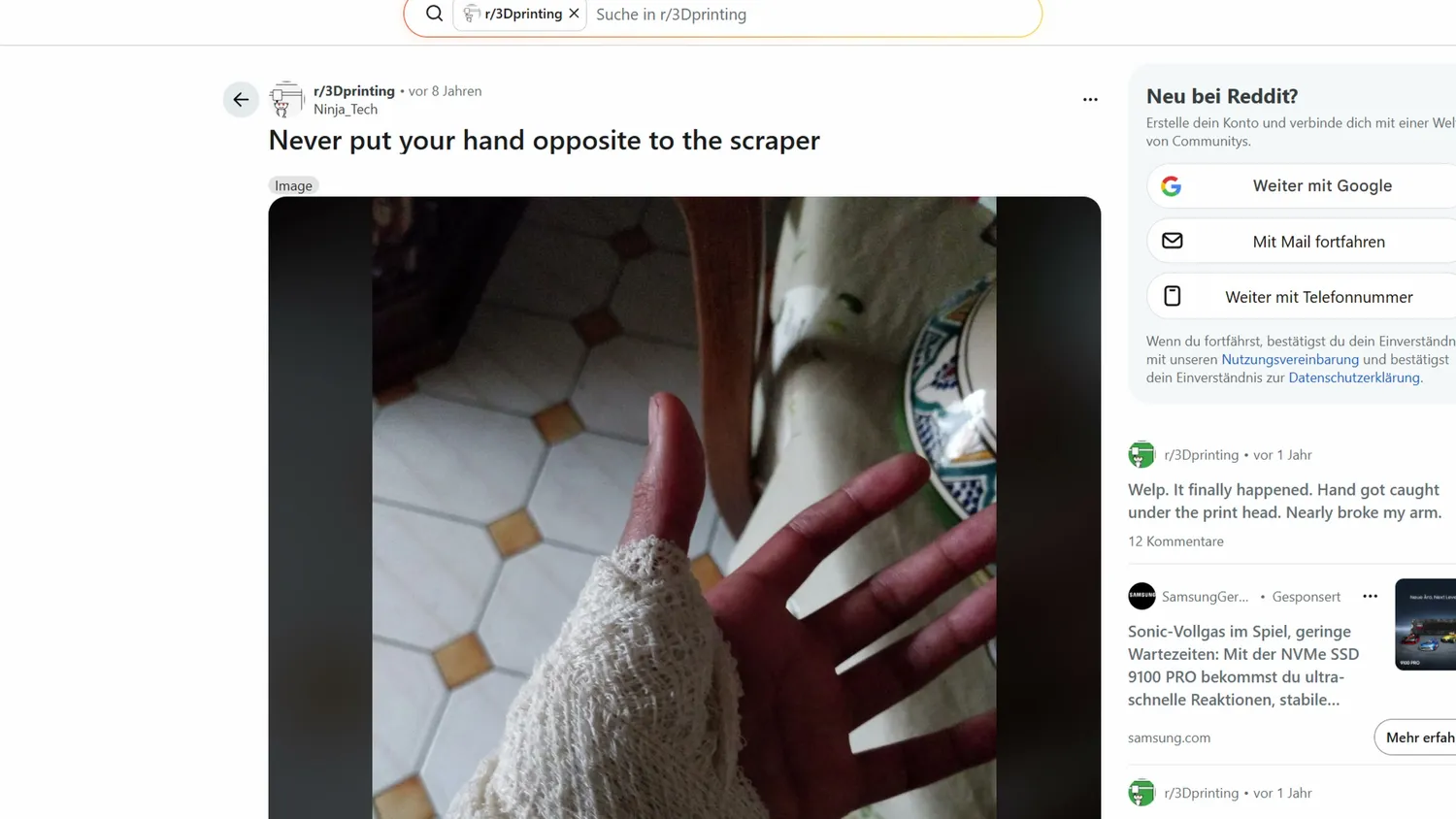 Reddit post warning never to put your hand opposite to the scraper